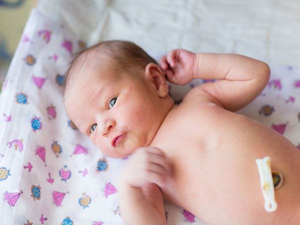 Rụng rốn ở trẻ sơ sinh: Khi nào mẹ cần lo?
