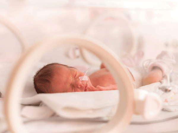 Tất cả về sinh non và nguy cơ mắc phải của trẻ sinh non