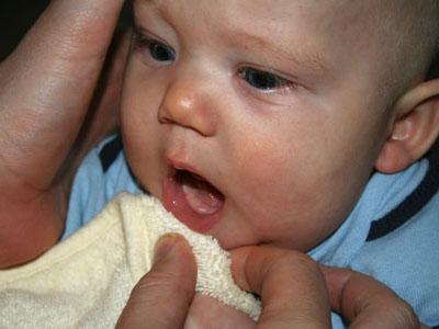 Rơ lưỡi cho trẻ sơ sinh thế nào mới chuẩn?