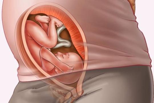 Sự phát triển của thai nhi tuần thứ 29
