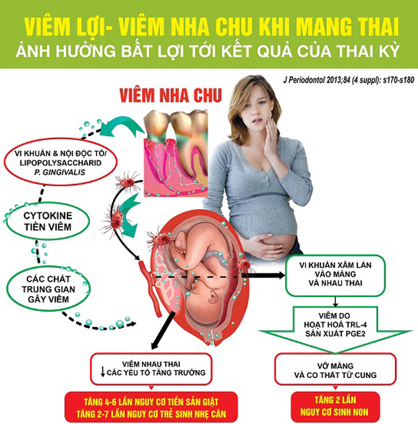 Cách chữa đau răng hiệu quả và an toàn cho thai nhi, mẹ bầu nên tham khảo