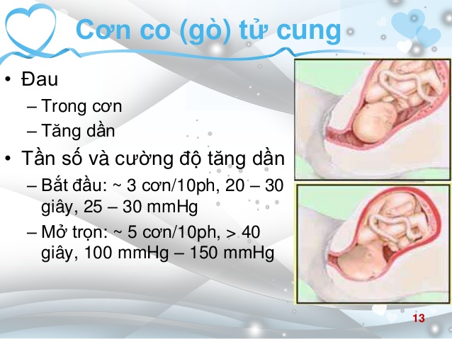 10 dấu hiệu chuyển dạ sắp sinh chính xác mẹ bầu nên nhớ