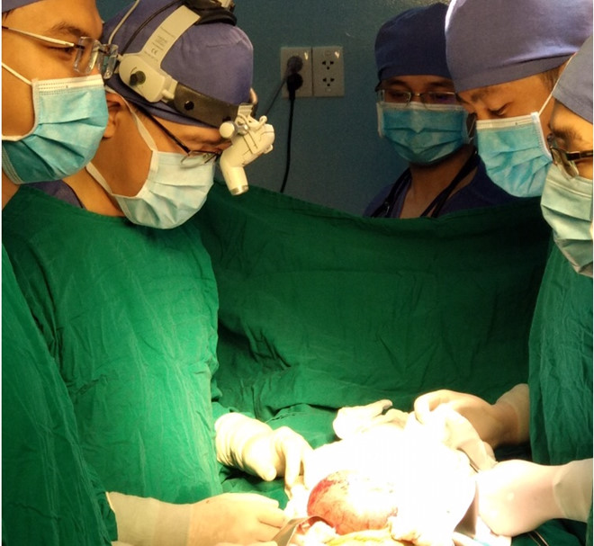 Trà Vinh xuất hiện bé trai mang khối u "thai trong thai" tỷ lệ 1/500.000