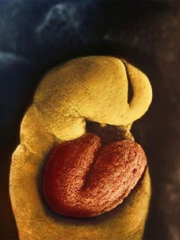Ngắm ảnh chụp quá trình phát triển của thai nhi chất nhất quả đất
