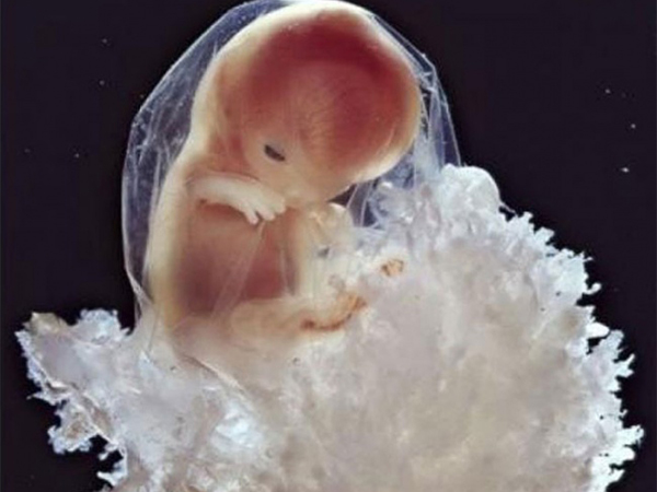 Ngắm ảnh chụp quá trình phát triển của thai nhi chất nhất quả đất