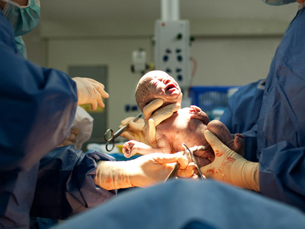 Trước khi sinh mổ, ăn ít cháo loãng cũng đe dọa tính mạng thai phụ