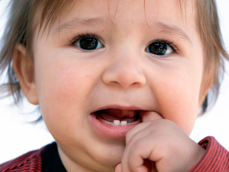 Những lưu ý khi chăm sóc răng sữa cho bé mẹ cần biết