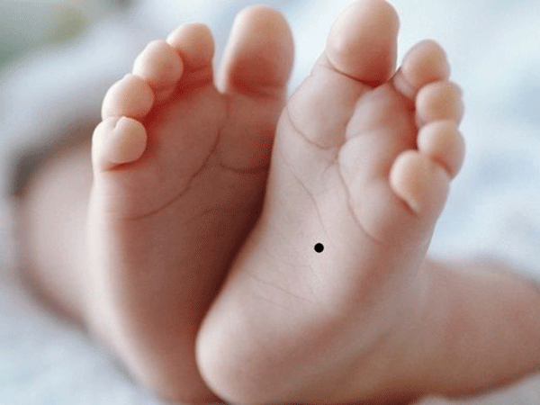 3 vị trí nốt ruồi ở trẻ sơ sinh dự báo vận mệnh phú quý suốt đời
