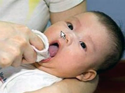 Nuôi con bằng sữa mẹ: Trẻ bị tưa lưỡi